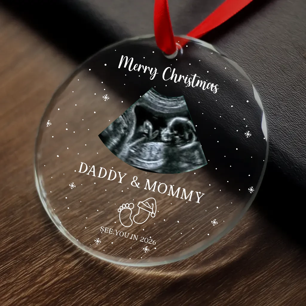 Custom Due Date Ultrasound Ornament